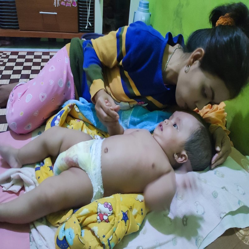 BAYI WIDIA ANAK TUKANG BASO GORENG, IDAP HYDROCEPHALUS
