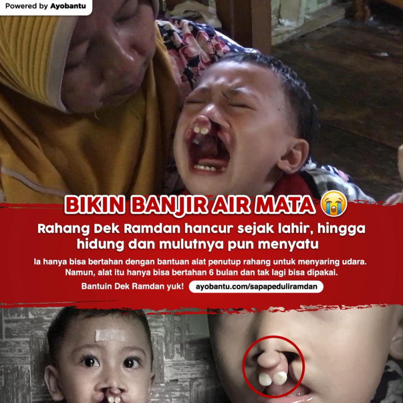 Rahang Hancur Akibatkan Saluran Pernapasan Terinfeksi