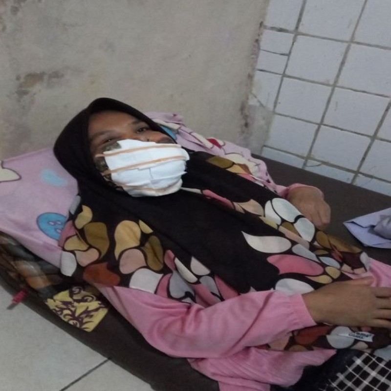 Urgent! Mulut dan Hidung Sudah Dipenuhi Tumor Ganas, Bantu Ibu Isoh Segera Berobat.