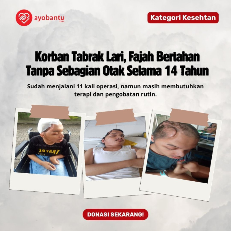 Fajah Masih Terus Bertahan denan Sebelah Tempurung Kepala, Bantu Perjuangan Fajah