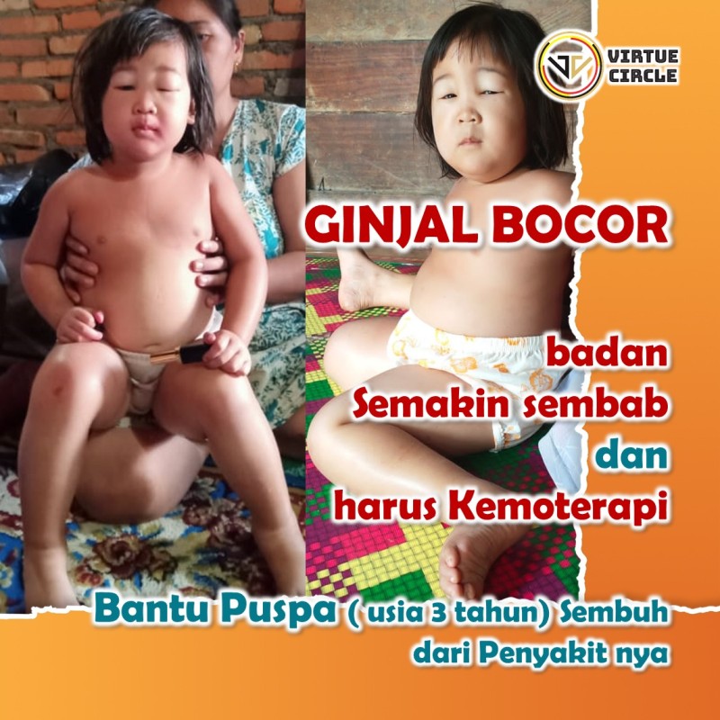 GINJAL BOCOR!!! Bantu Puspa agar bisa Kemoterapi