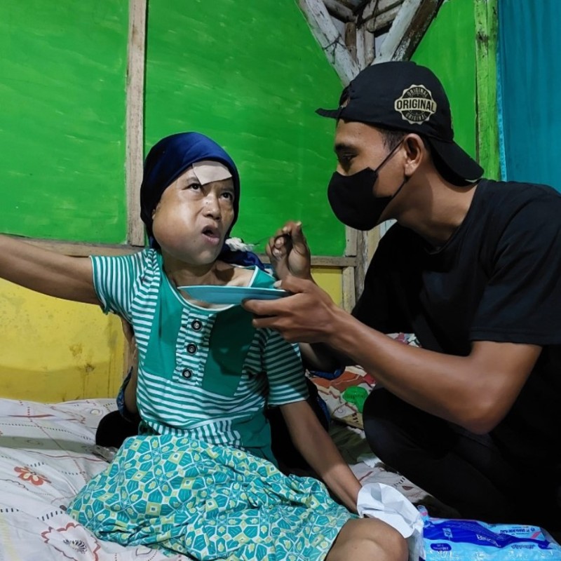 Bantu Turyatmi Sembuh Dari Tumor Ganas !