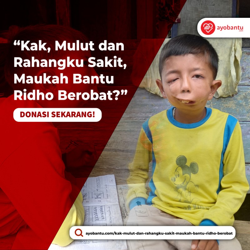 Kak, Mulut dan Rahangku Sakit, Maukah Bantu Ridho Berobat?