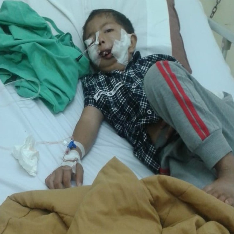Kak, Mulut dan Rahangku Sakit, Maukah Bantu Ridho Berobat?