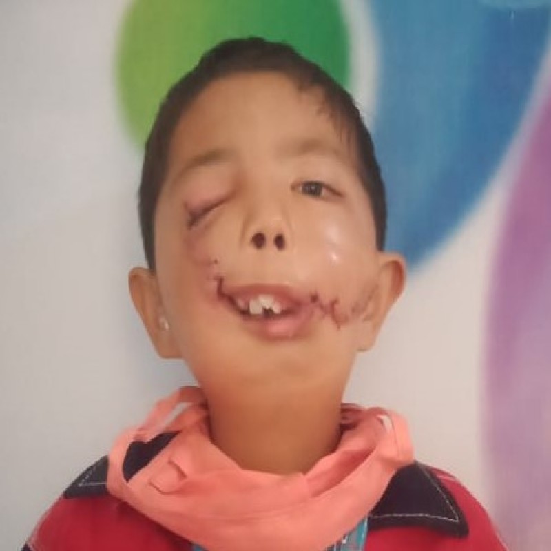 Kak, Mulut dan Rahangku Sakit, Maukah Bantu Ridho Berobat?