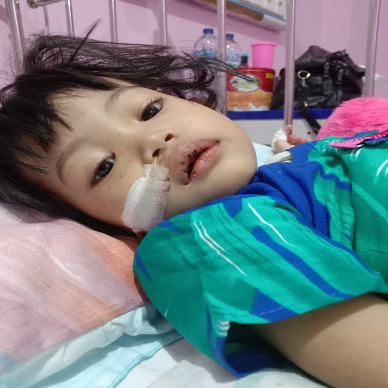 Divonis Leukemia akut dan Gangguan Pendengaran, Bantu Hafsya Berjuang Untuk Sembuh