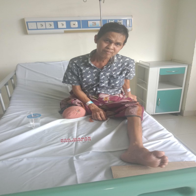 Wujudkan Harapan Pak Supian Mempunyai Kaki Palsu