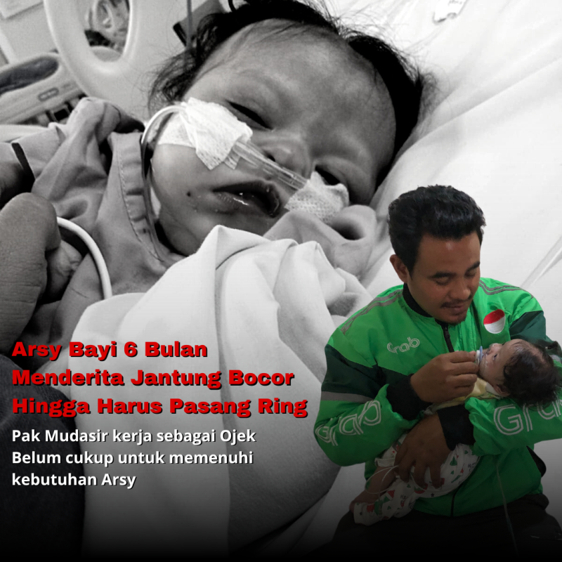 Derita Bocor Jantung, Arsy Harus Segera di Obati