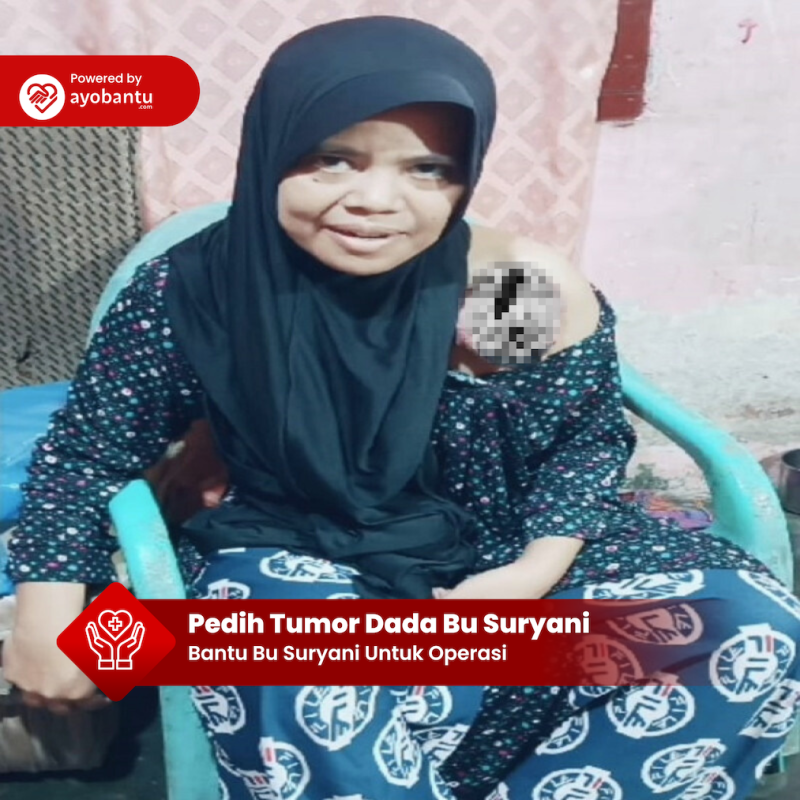 Tumor di Dada Suryani Harus Segera Dioperasi