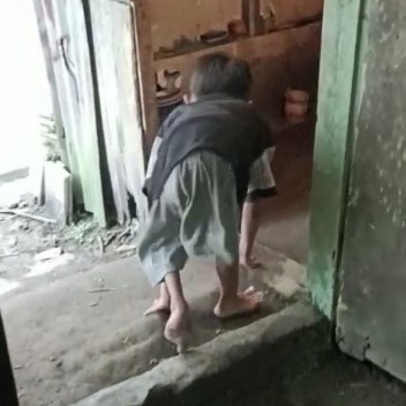 Tubuh dan Kakinya Semakin Mengurus ! Hanya Bisa Merangkak