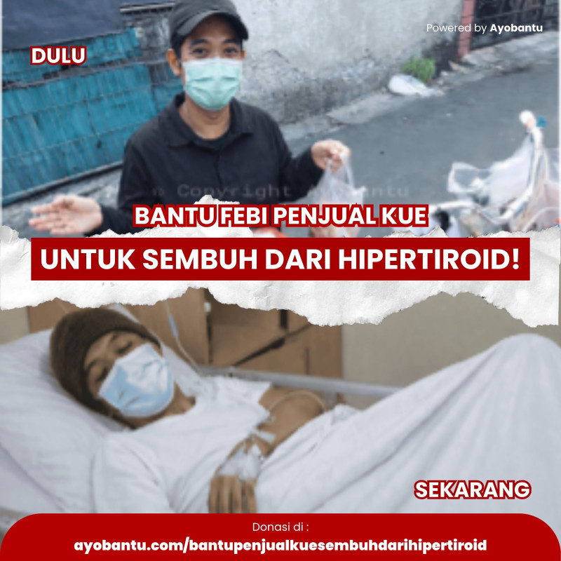 Bantu penjual kue sembuh dari Hipertiroid