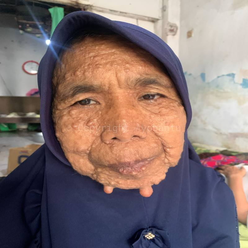 Bantu Kehidupan Ibu Sulastri dan Orang Tua Lumpuh