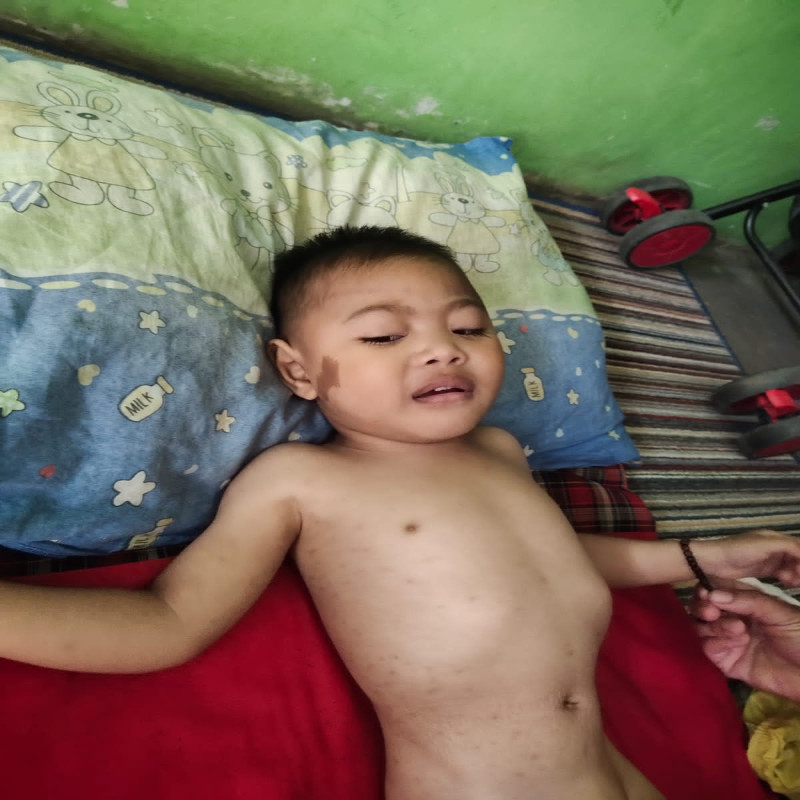 BERJUANG MELAWAN PENYAKIT NYA , BANTU HISYAM UNTUK SEMBUH