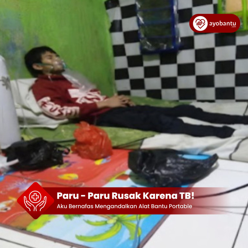 Paru paru rusak saipul butuh alat bantu nafas portabel