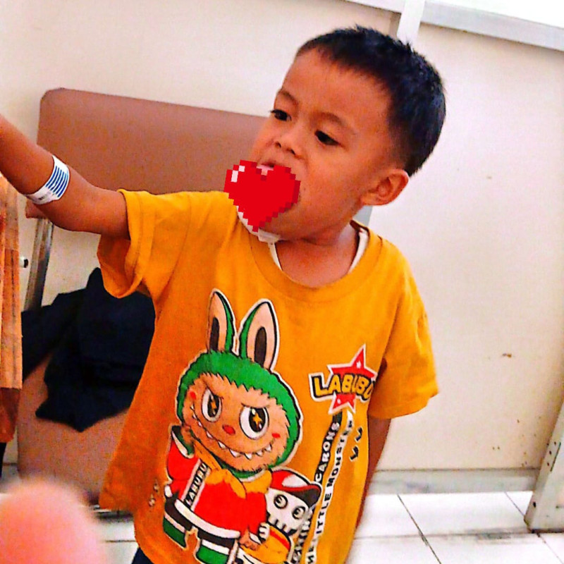 Bantu Febio (5 th) Melawan Tumor Lidah — Biaya Perawatan & Transportasi