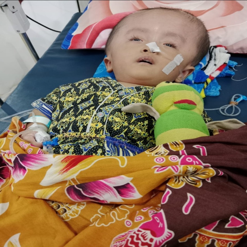 Hidrosefalus Epilepsi dan Spinabifida 3 Penyakit Sekaligus Menyerang Fariz!!