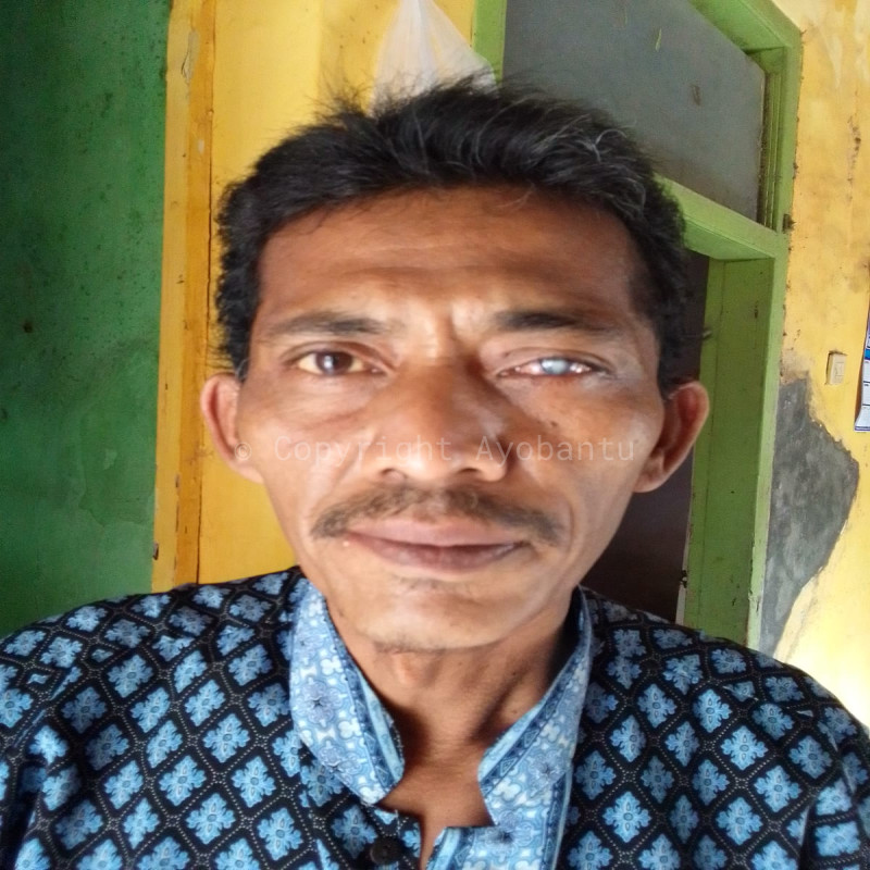 Bantu bapak Warjo melawan penyakit infeksi mata (glaucoma)