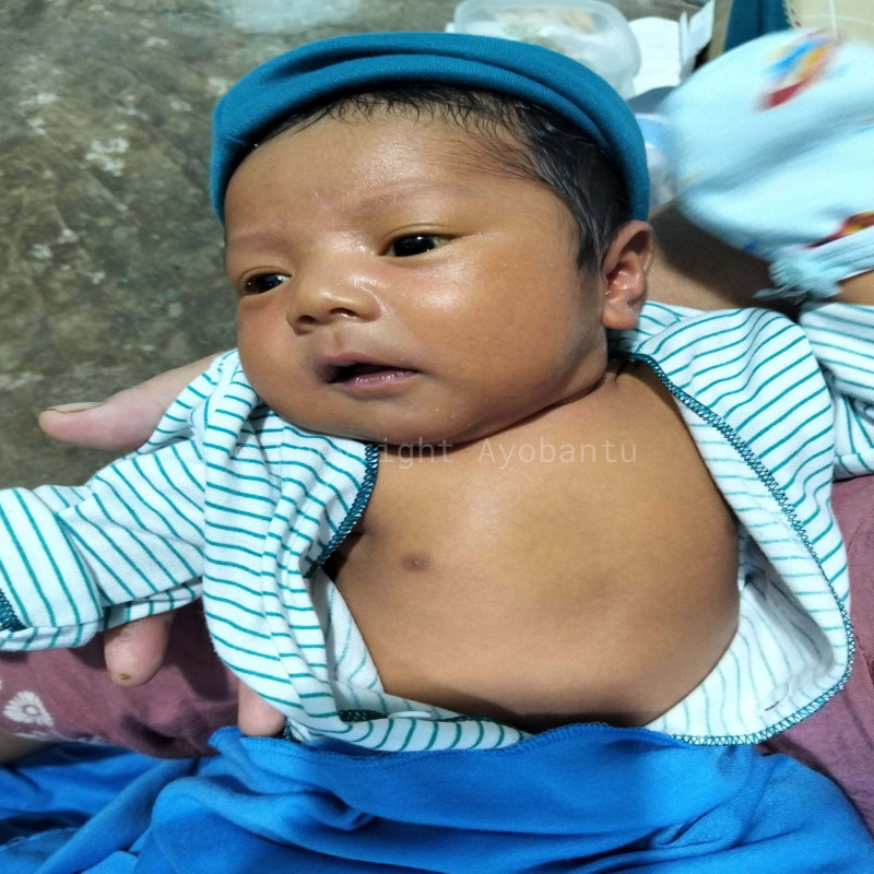 Bantu bayi ALFI sembuh dari penyakit-penyakit jantung langka TRUNCUS ARTERIOSUS