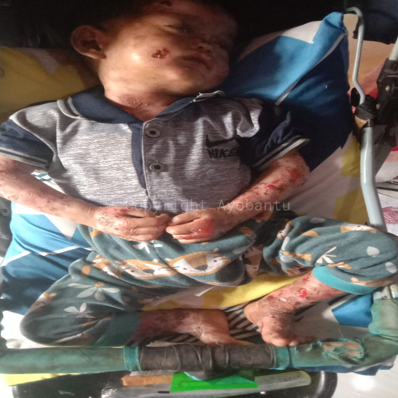 Bantu Bu Ningsih dan Adik Dava Sembuh dari Penyakitnya!