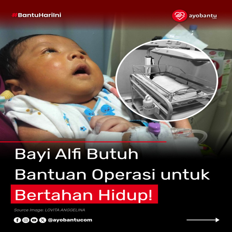 Bantu bayi ALFI sembuh dari penyakit-penyakit jantung langka TRUNCUS ARTERIOSUS