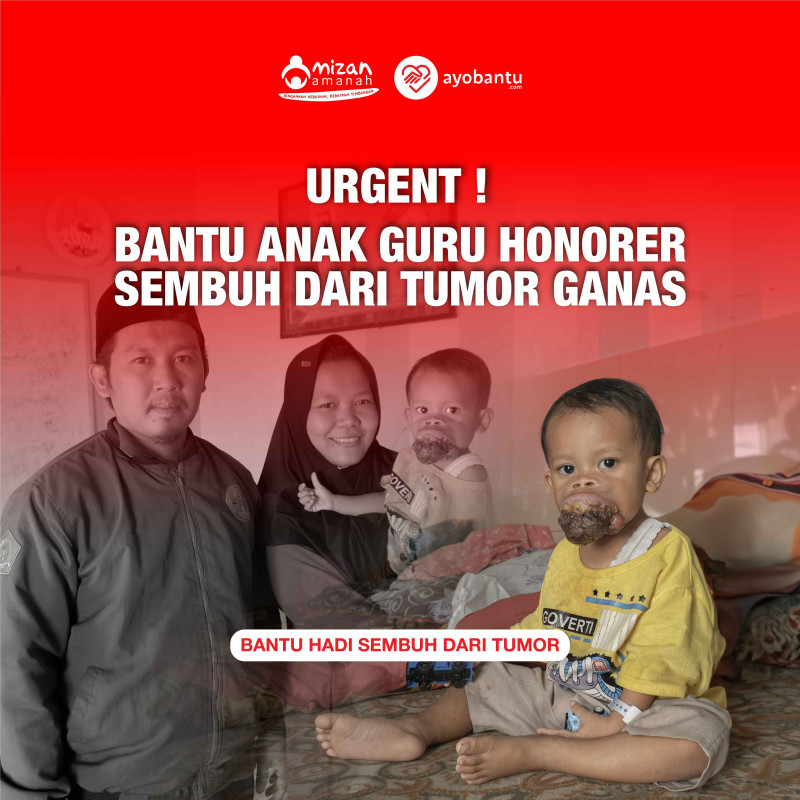 URGENT! Bayi Guru Honorer Derita Tumor Ganas Di Mulutnya!