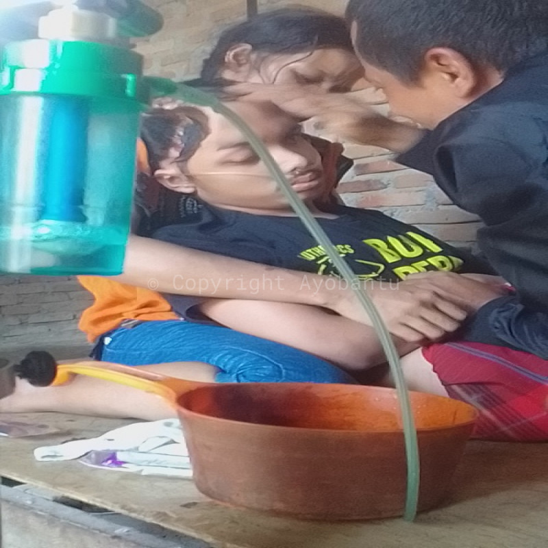 Fajah Masih Terus Bertahan denan Sebelah Tempurung Kepala, Bantu Perjuangan Fajah