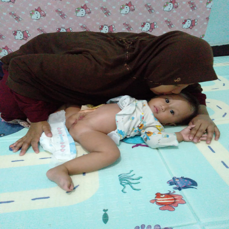 Bantu Operasi Lubang Anus dan Kelamin Anak Penjual Cimol