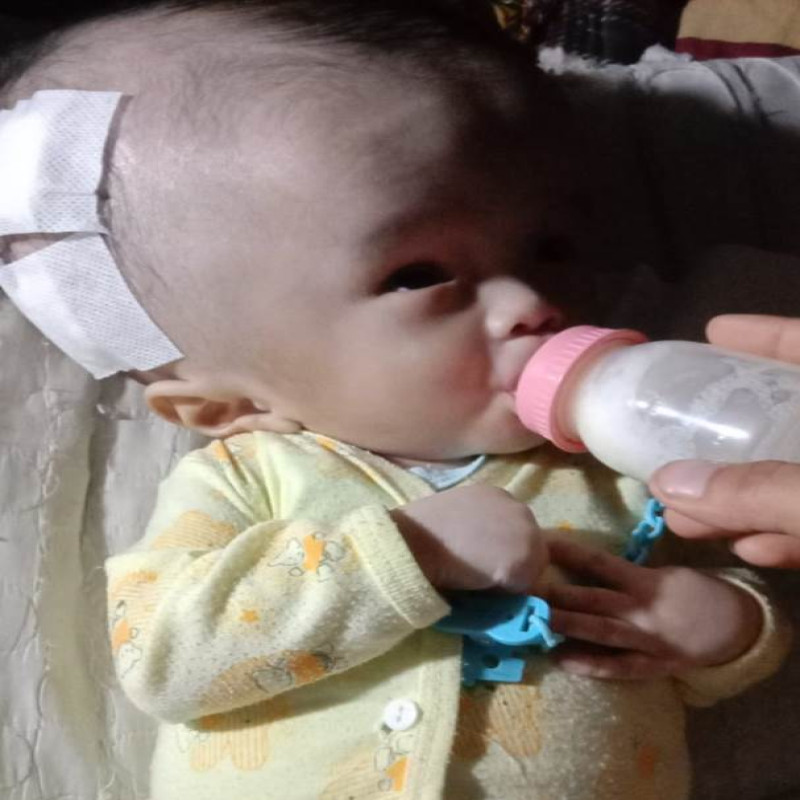 Ayo Selamatkan Bayi Defgan dari Hidrosefalus