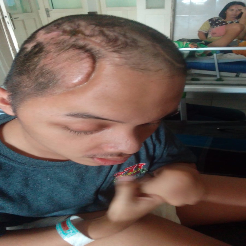 Fajah Masih Terus Bertahan denan Sebelah Tempurung Kepala, Bantu Perjuangan Fajah