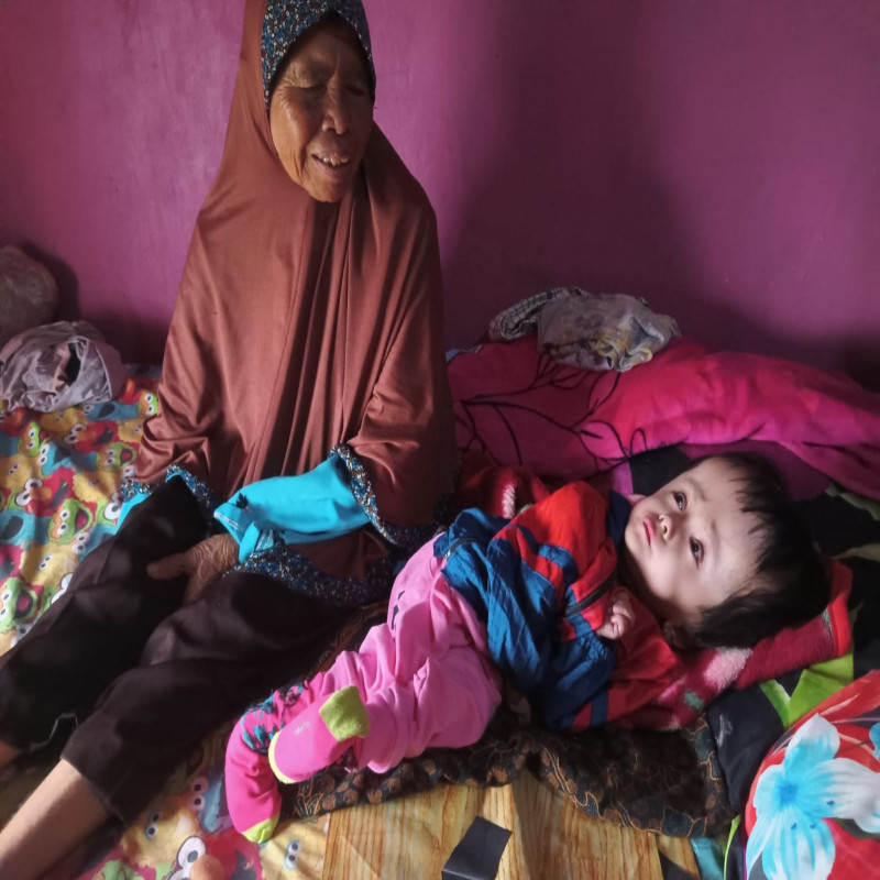 Kepala Terus Membesar, Bantu Putri Sembuh dari Penyakit Hidrosefalus