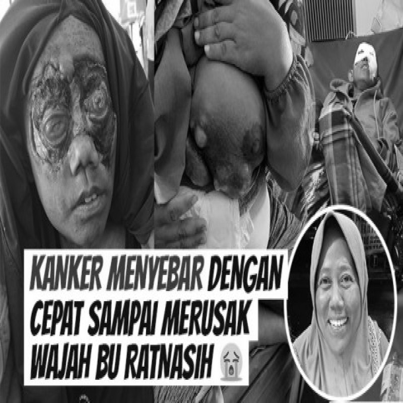 TOLONG IBU RATNASIH HARUS SEGERA OPRASI!!
