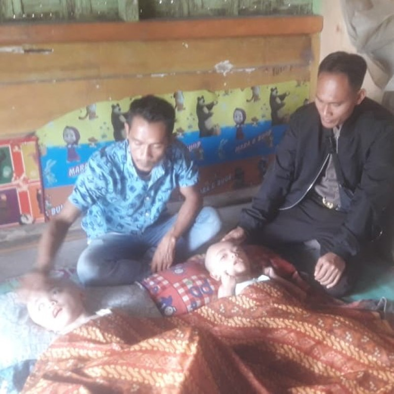 Mengidap Hidrosefalus, Bantu Davin Sembuh
