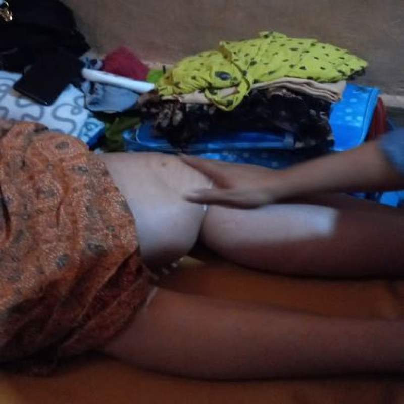 Idap Tumor Ganas Hingga Membengkak, Kaki Bu Yeni Terancam Diamputasi