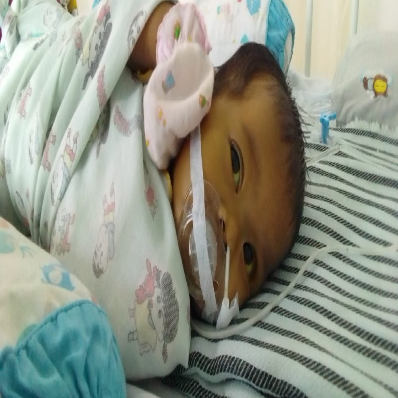 Bantu Selamatkan Nyawa Bayi Kami yang Harus Transplantasi Hati
