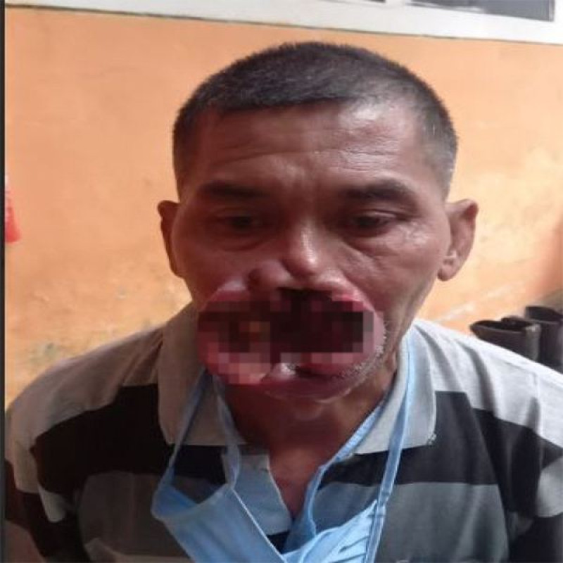 Kanker Pudarkan Senyuman Pak Enjat, Tolong! Bantu Guruku Segera Berobat.