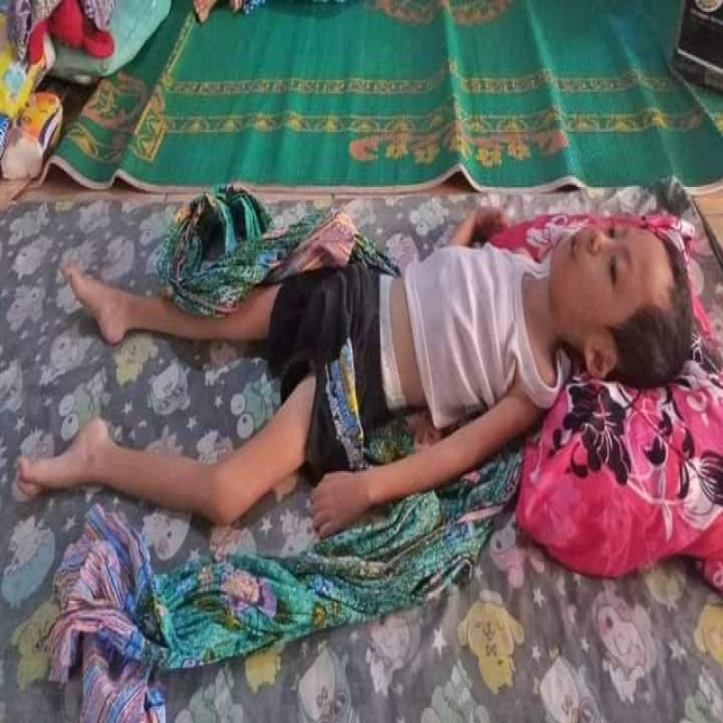 Anak Yatim Lumpuh Otak Tidak Bisa Berobat