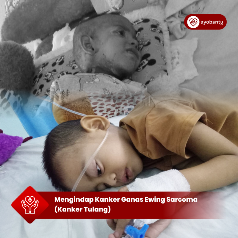 Mengindap Kanker Ganas Ewing Sarcoma (Kanker Tulang)