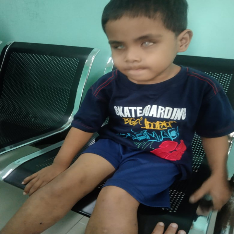 Agar Kanker Tak Lari Ke Otak, Alif Korbankan Mata