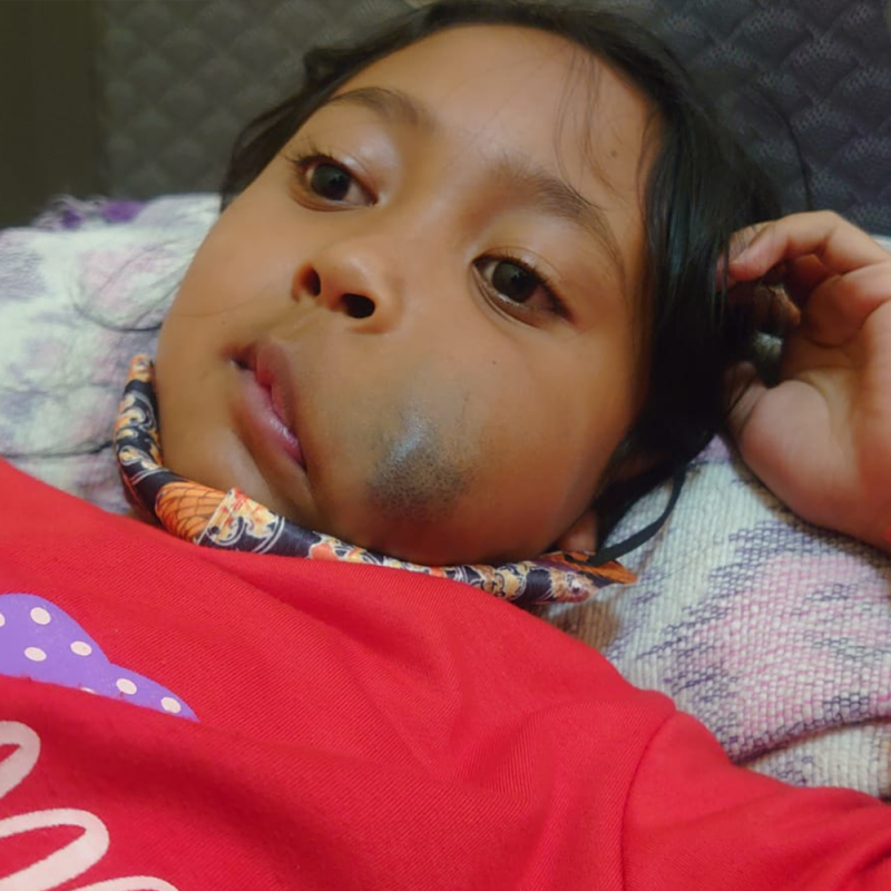Trisabila dan Harapan Sembuhnya