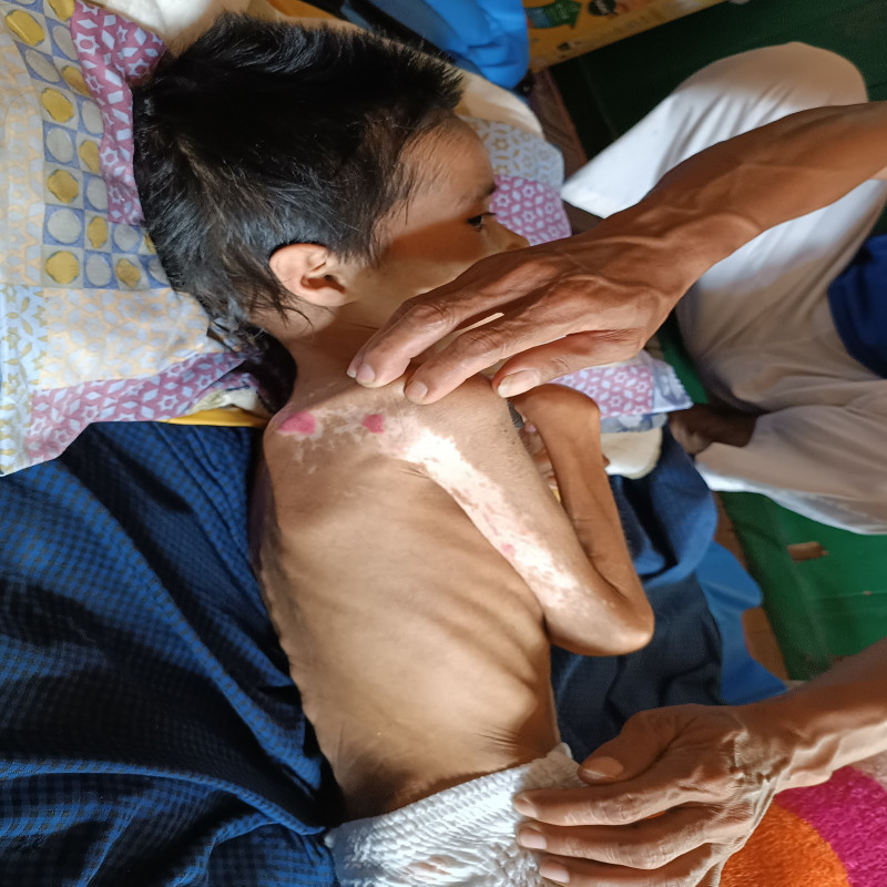 Bantu Ramdhan (8th), Anak Tukang Jahit Keliling Berjuang Lawan Gizi Buruk dan Cerebral Palsy