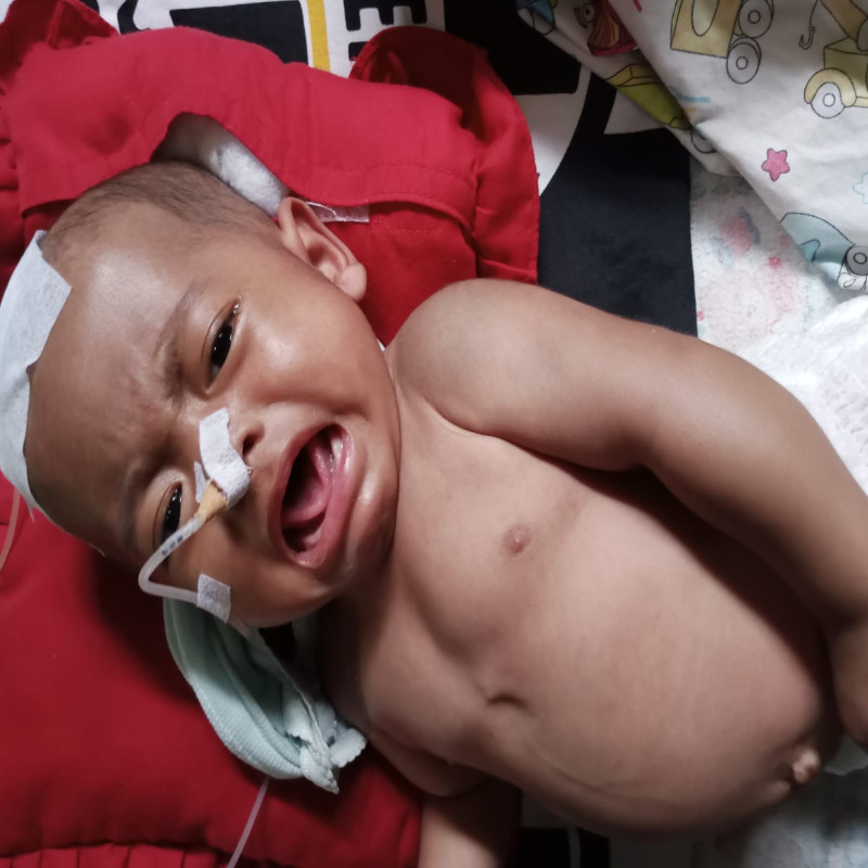 Urgent!!! Bayi fatih harus segera operasi kepala