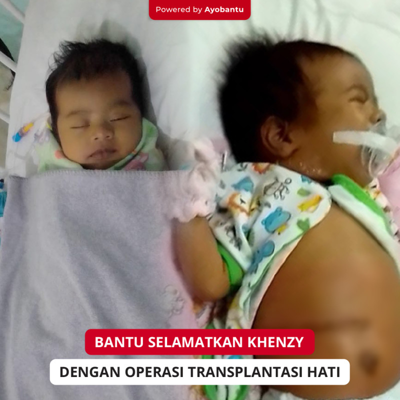 Bantu Selamatkan Nyawa Bayi Kami yang Harus Transplantasi Hati