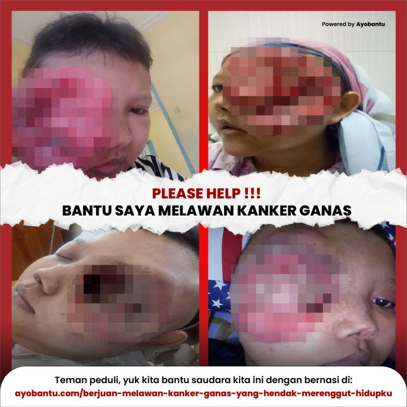 Berjuang Melawan Kanker Ganas yang Hendak Merenggut Hidupku