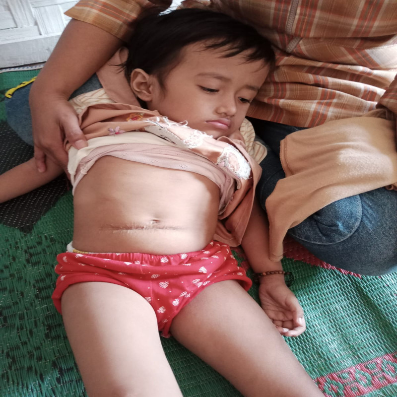 ANAK SEORANG TUKANG GORENGAN IDAP HIDROSEFALUS