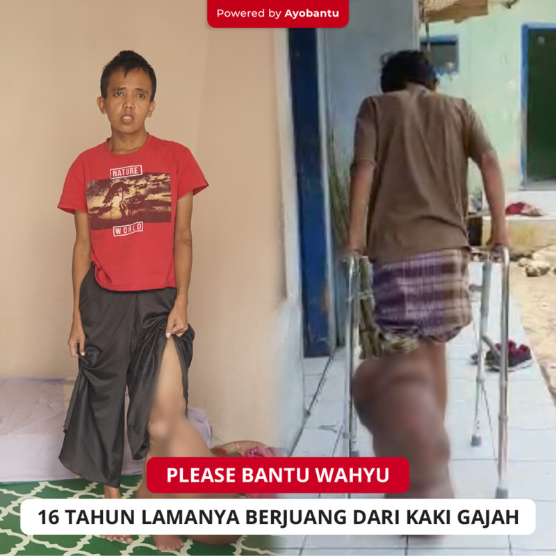 Sudah 16 tahun lamanya, Wahyu (24 tahun) dengan sabar menanti kesembuhannya.