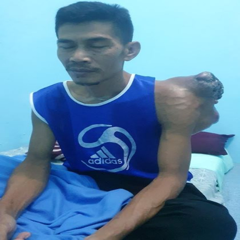 Tumor Ganas Pudarkan Harpan Pak Mahdi, Bertahan Berharap Keajaiban, Bantu sekarang!
