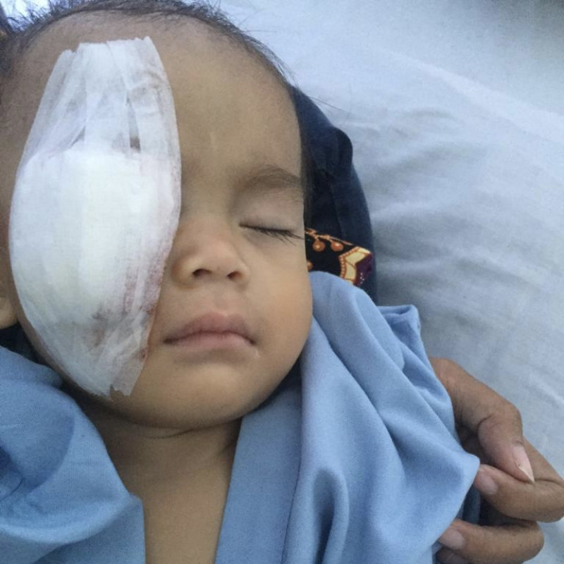 Kanker Merenggut Mata dan Mengancam Nyawa, Tolong Ciara!