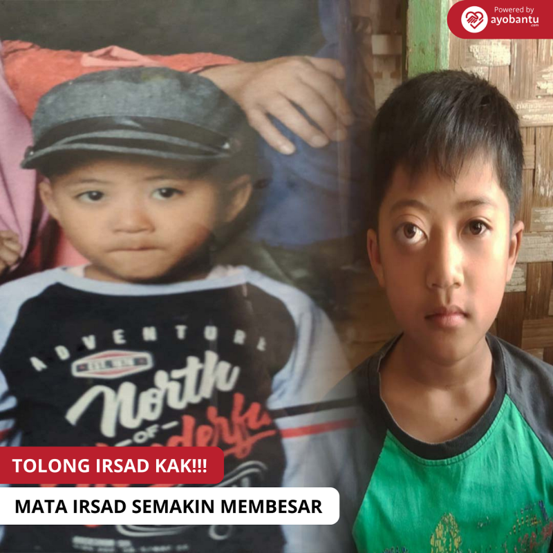 TOLONG!!! MATA IRSAD SEMAKIN MEMBESAR