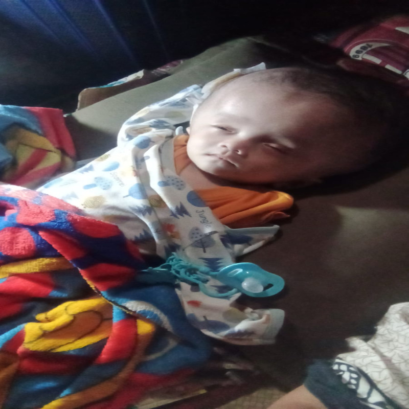 Ayo Selamatkan Bayi Defgan dari Hidrosefalus