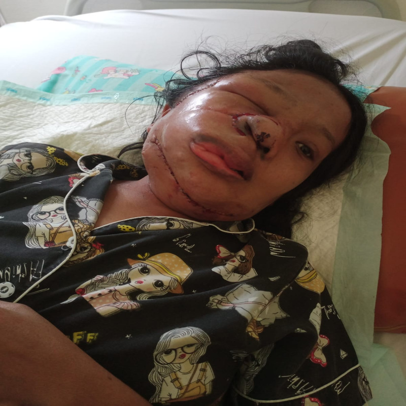 Tolong! Bantu Pasien Kanker Dhuafa Tak Mampu Berobat